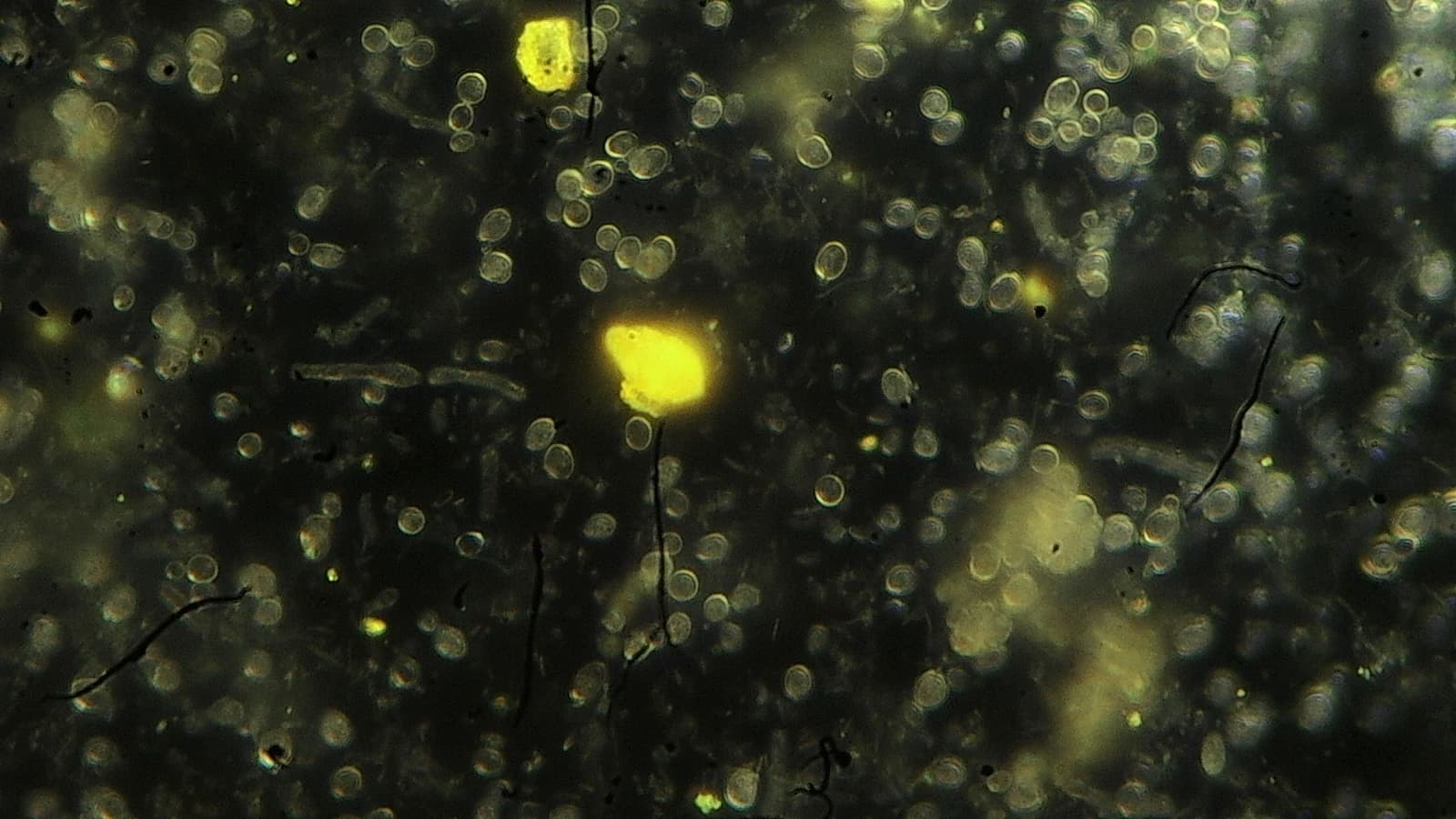 Gota de San Viver observada al microscopio de campo oscuro — cocos y bacilos vivos en la matriz fermentada